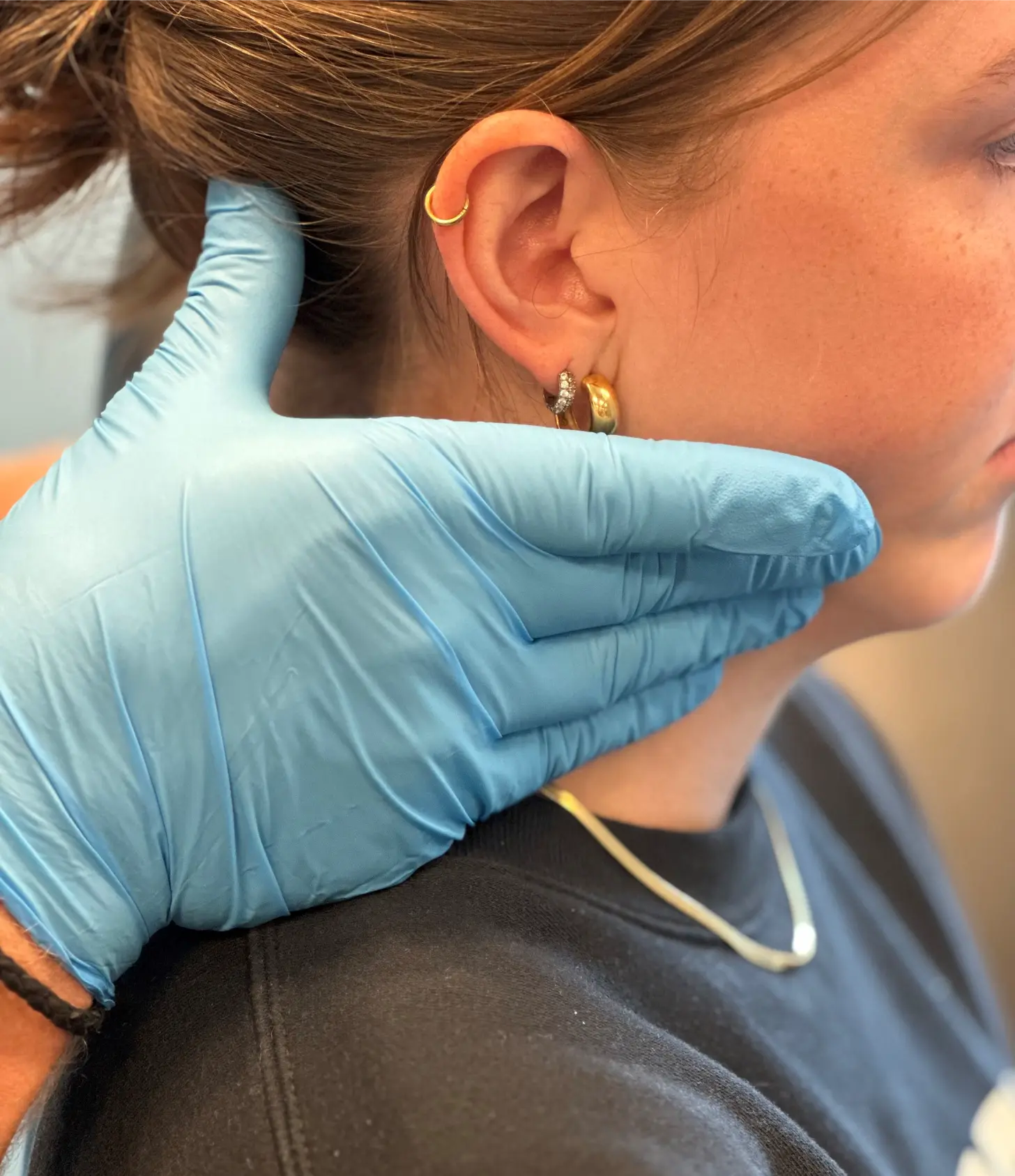 TMJ Burlington patient treatment