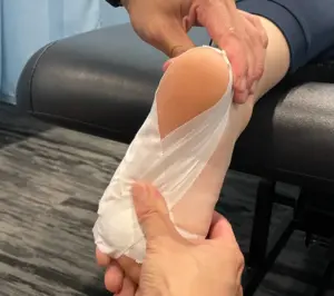 plantar fasciitis foot tape
