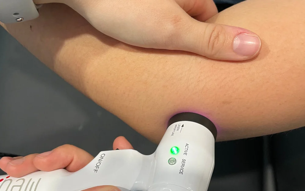 lateral elbow laser 1