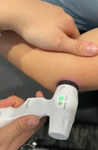 Cold Laser Therapy Sheddon Physio Burlington