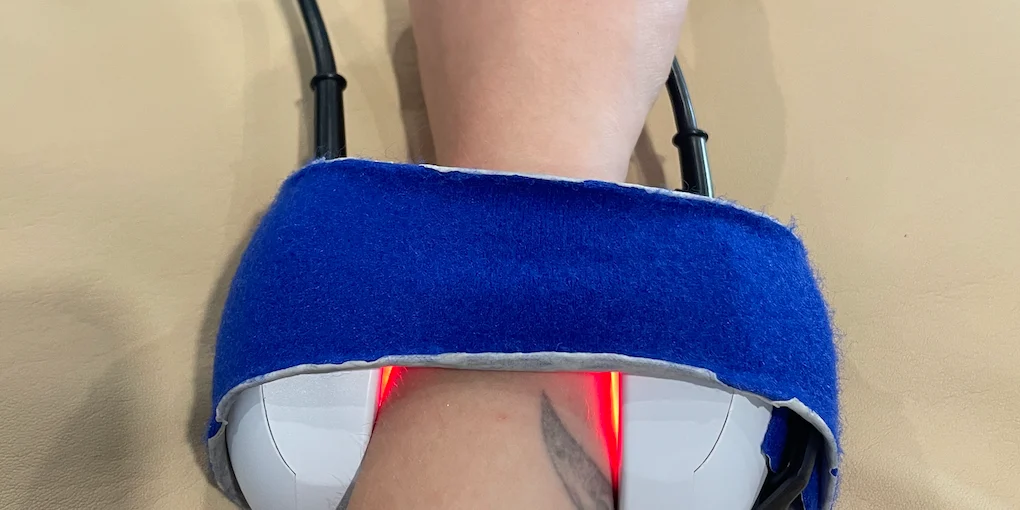 Cold Laser Treatment Sheddon Physio Burlington