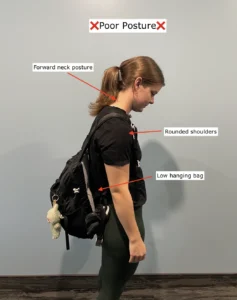 Student with poor posture carrying backpack showing forward head and rounded shoulders