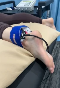 Achilles physiotherapy shockwave treatment Burlington